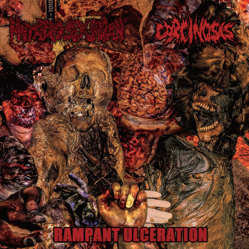 Carcinosis : Rampant Ulceration